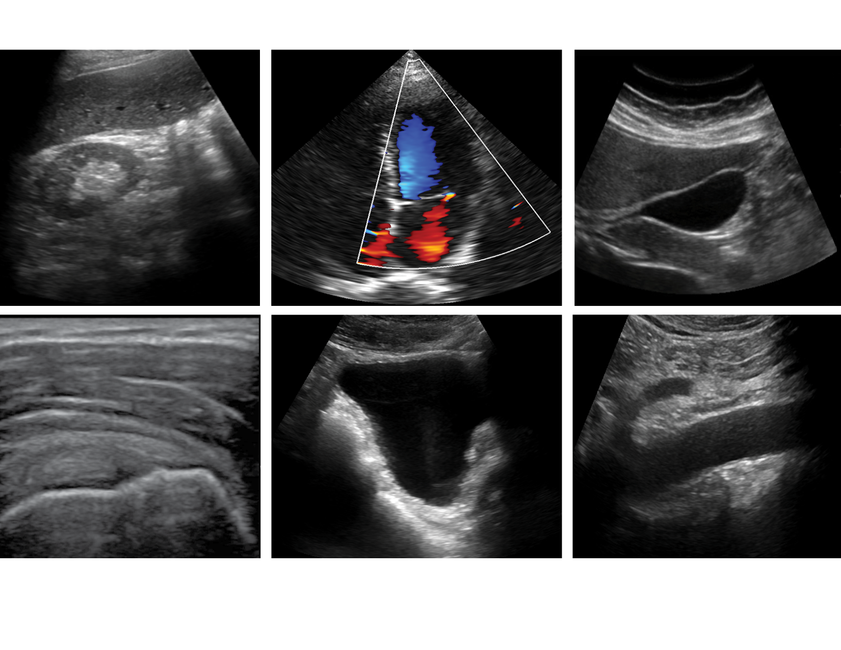 What is POCUS? Advanced Medical Imaging | EXO INC
