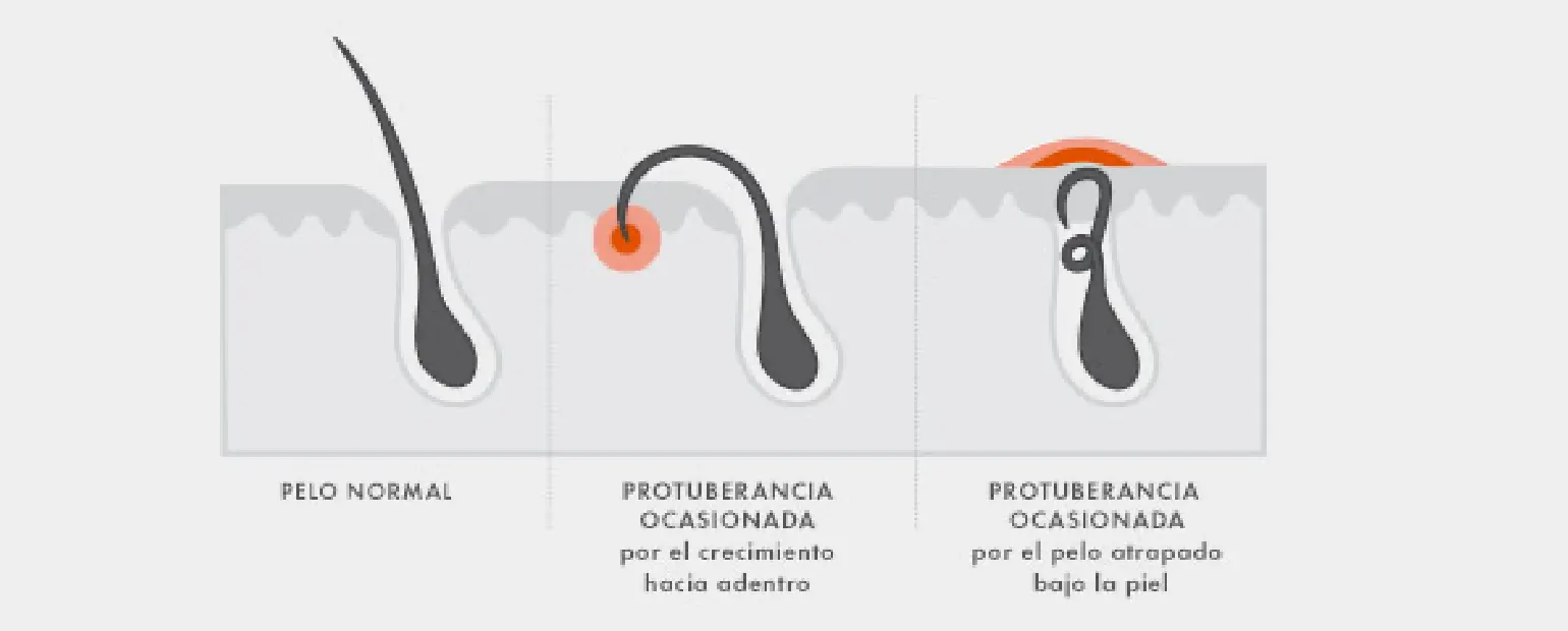 Consejos para minimizar las protuberancias en la afeitada