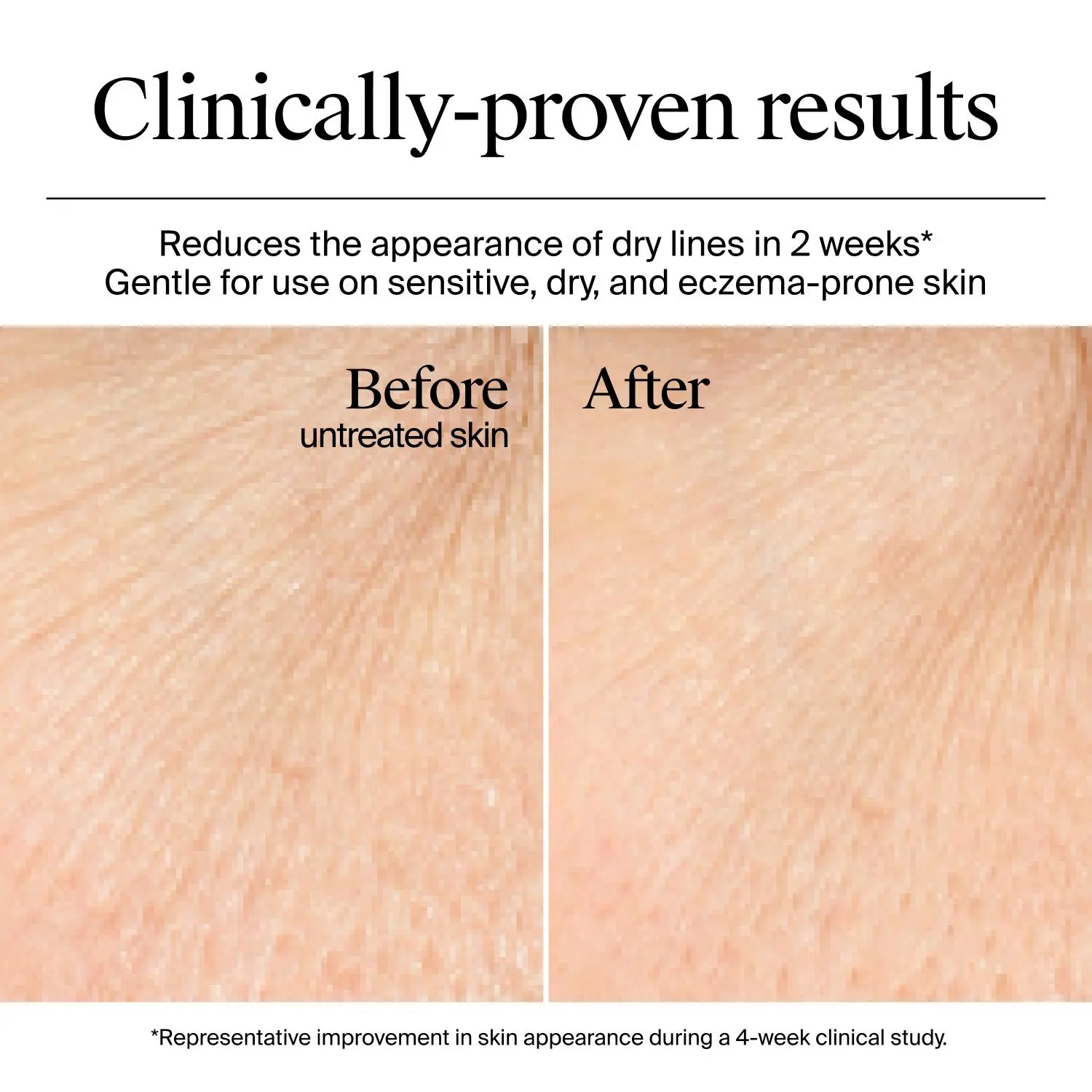 Before and after skin results from using Neutrogena Hydro Boost Gel Cream (Fragrance-Free) after a 4-week clinical study