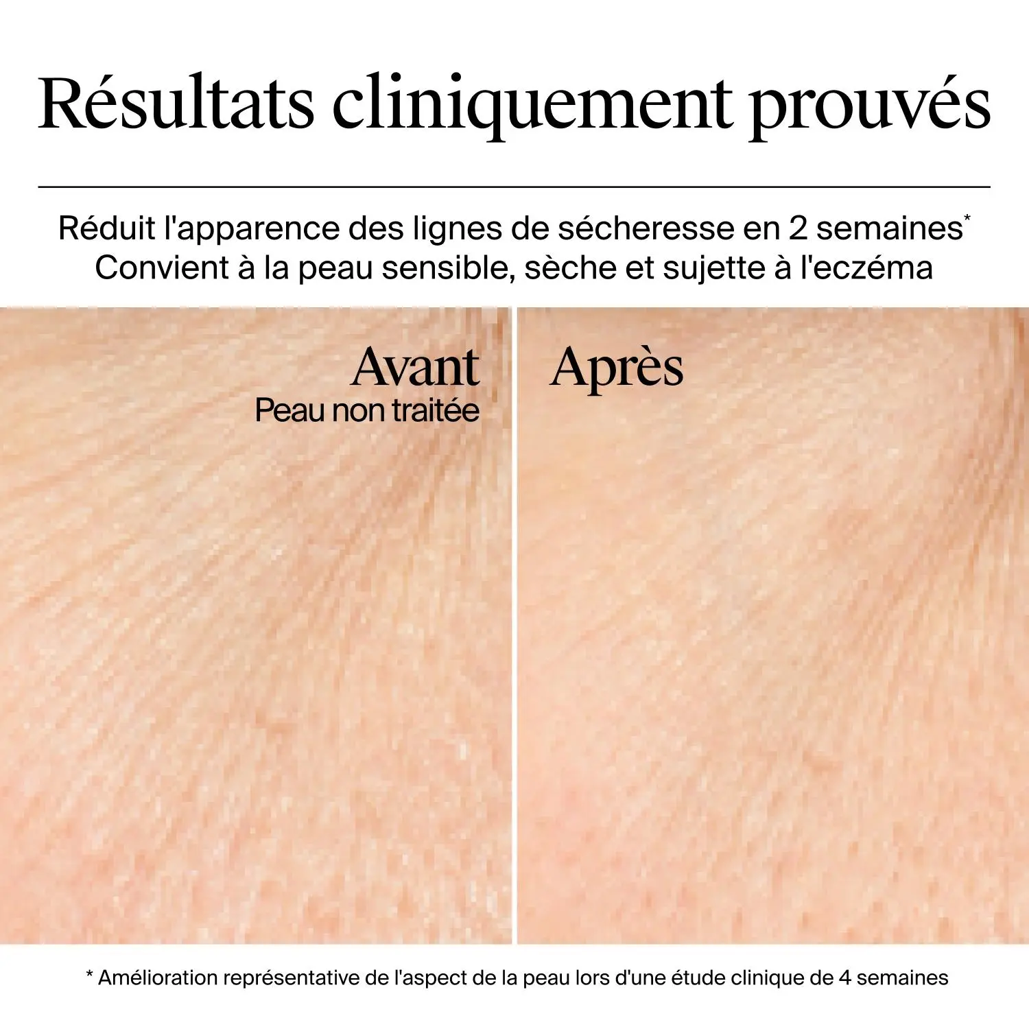 Résultats avant et après utilisation du gel-crème Hydro Boost de Neutrogena (sans parfum), après une étude clinique de 4 semaines