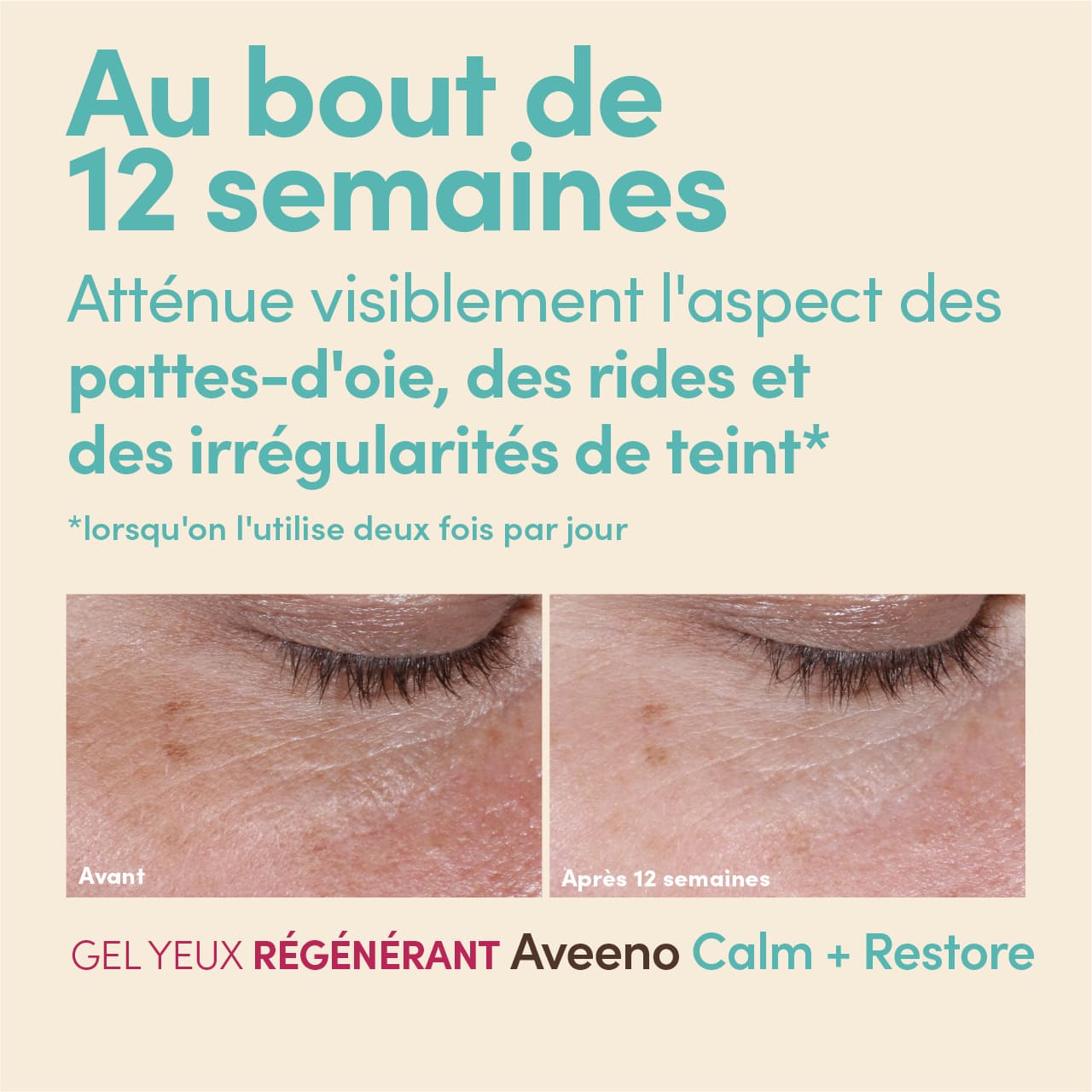 Photos avant et après de la zone sous les yeux après l’utilisation du gel pour les yeux avec la revendication « atténue l’apparence des pattes-d'oie, des rides et du teint irrégulier en 12 semaines ».