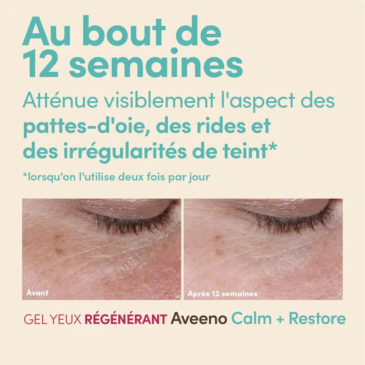 Photos avant et après de la zone sous les yeux après l’utilisation du gel pour les yeux avec la revendication « atténue l’apparence des pattes-d'oie, des rides et du teint irrégulier en 12 semaines ».