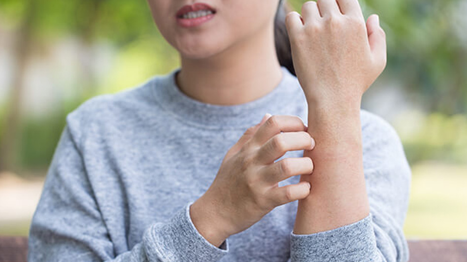 Woman scratching her arm