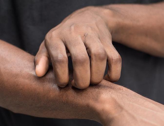 A person itching their arm due to eczema