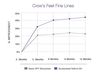 Crows Feet Chart comparing NEUTROGENA® Retinol SA vs a Basic SPF Moisturizer.