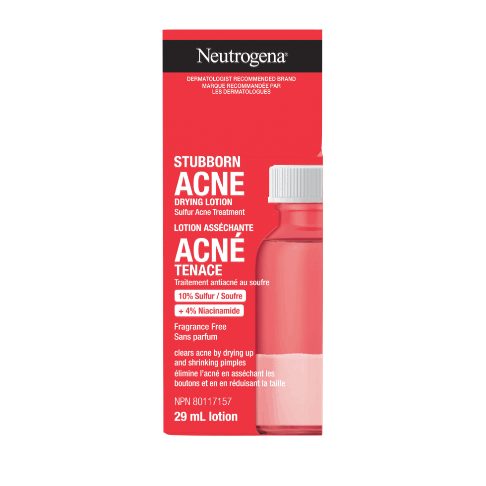 29 ml bottle of Neutrogena Stubborn Acne Drying Lotion