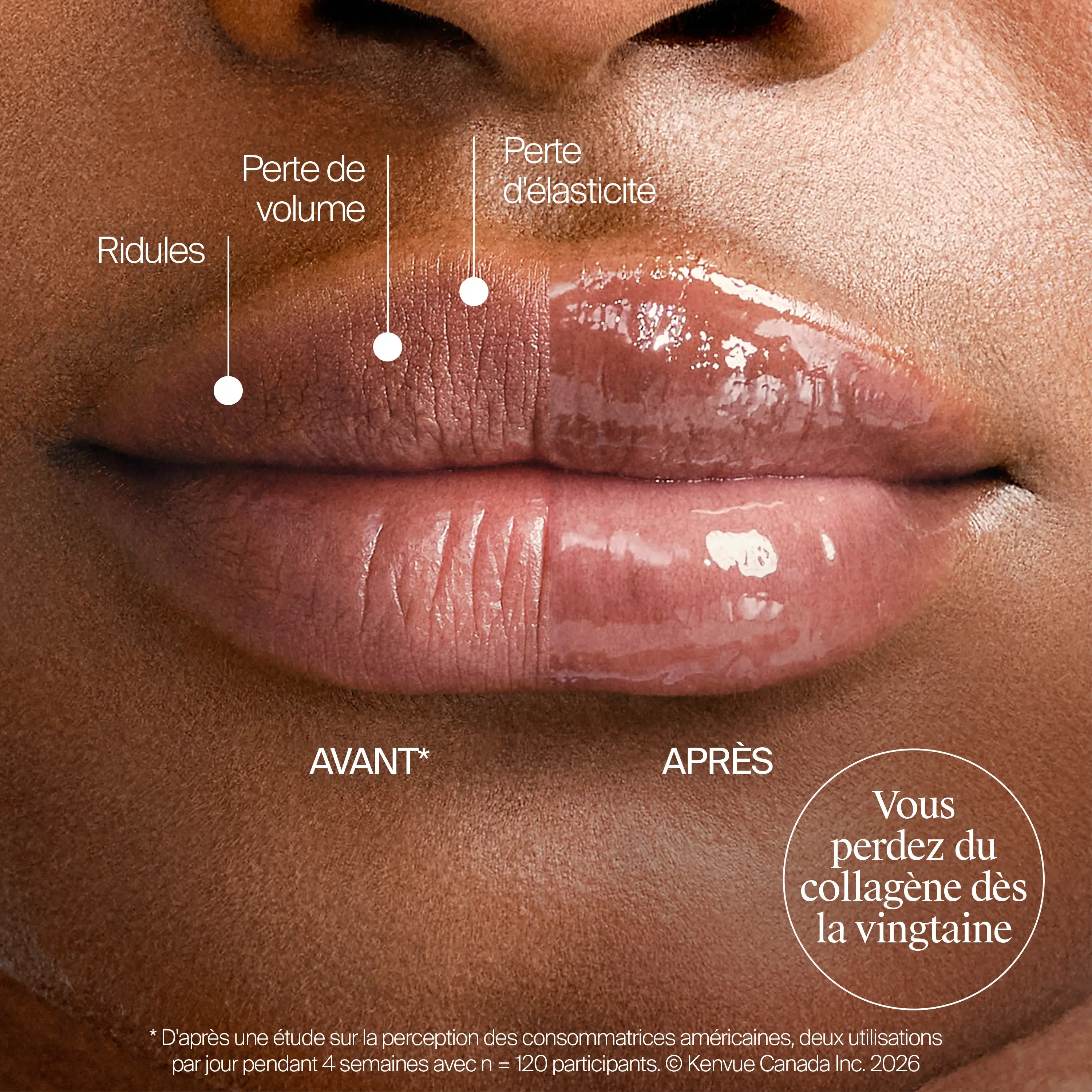 Traitement Repulpant Pour Les Lèvres Neutrogena Collagen Bank® Vanille