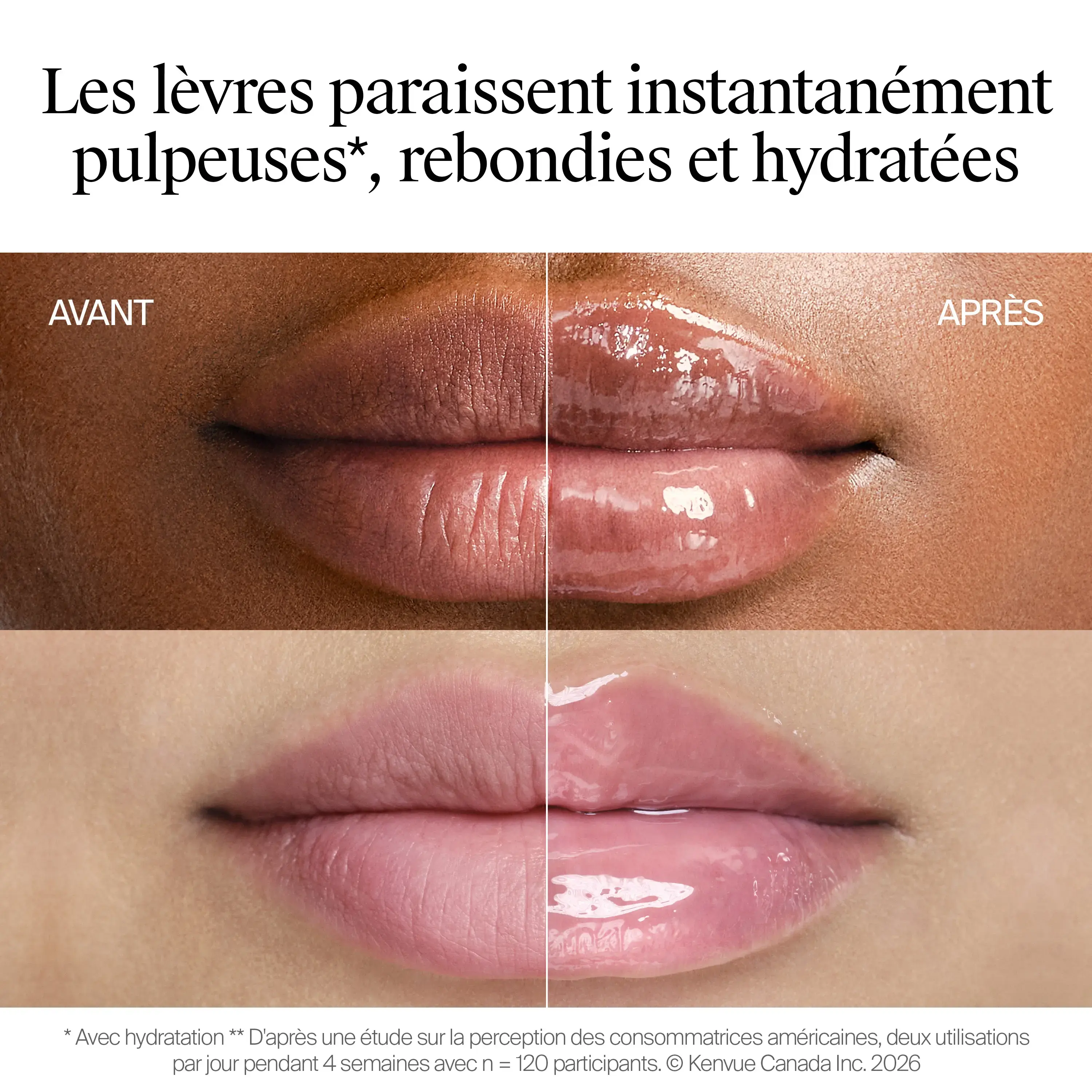 Traitement Repulpant Pour Les Lèvres Neutrogena Collagen Bank® Vanille