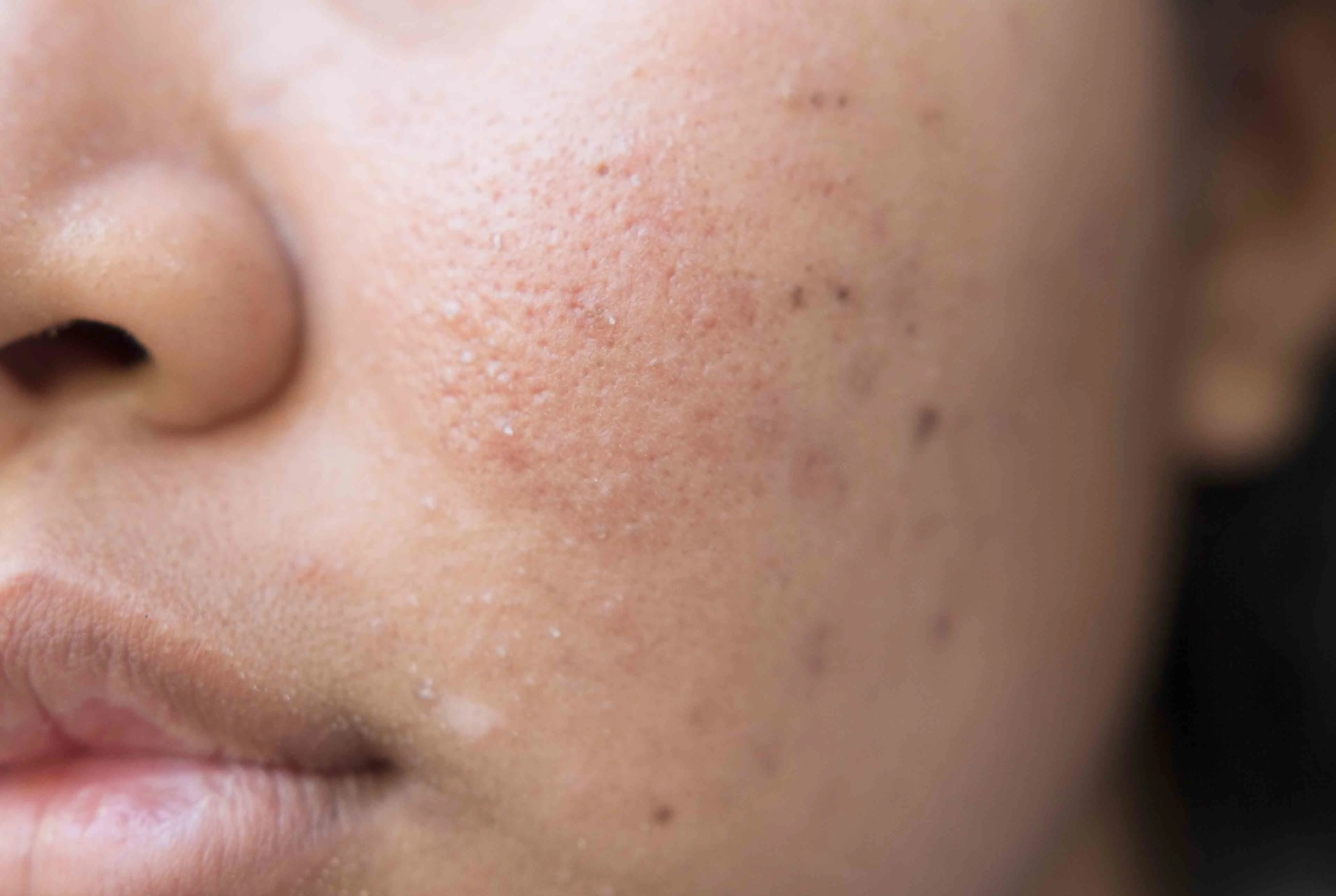 Face with textured skin and uneven skin tone