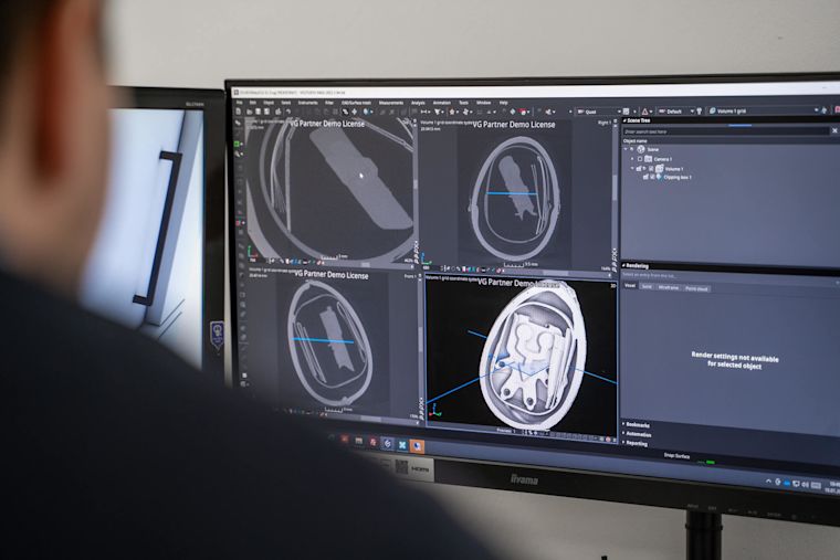 Computerbildschirm mit Anzeige von CT-Scans.