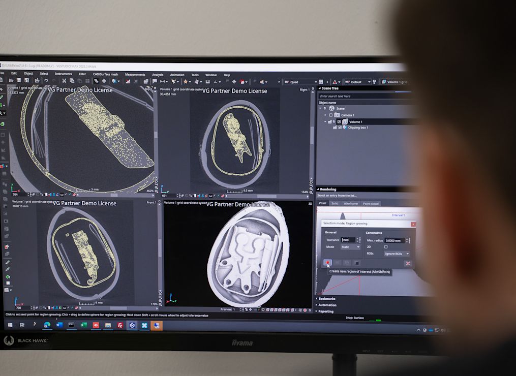 Computerbildschirm mit Anzeige von CT-Scans.