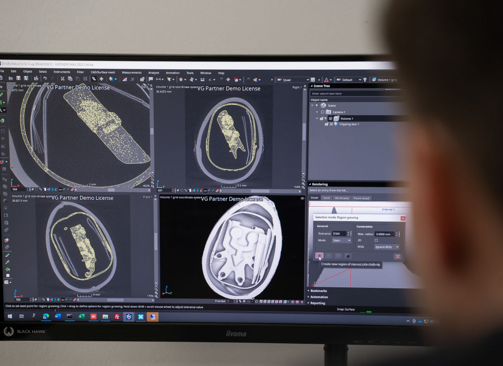 Computer screen with ct scans displayed.
