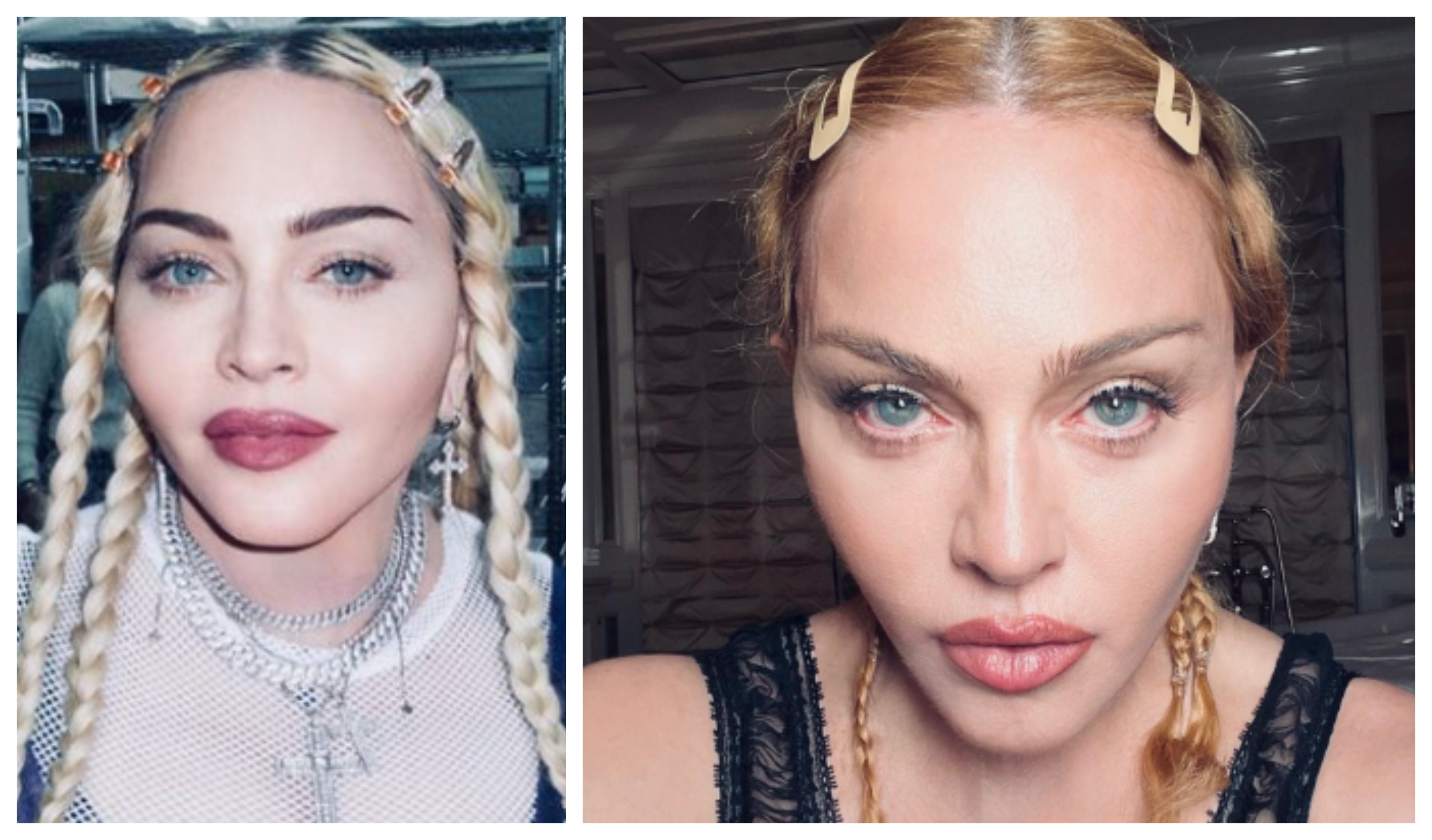 Madonna Taken To Hospital In New York City After She Is Found