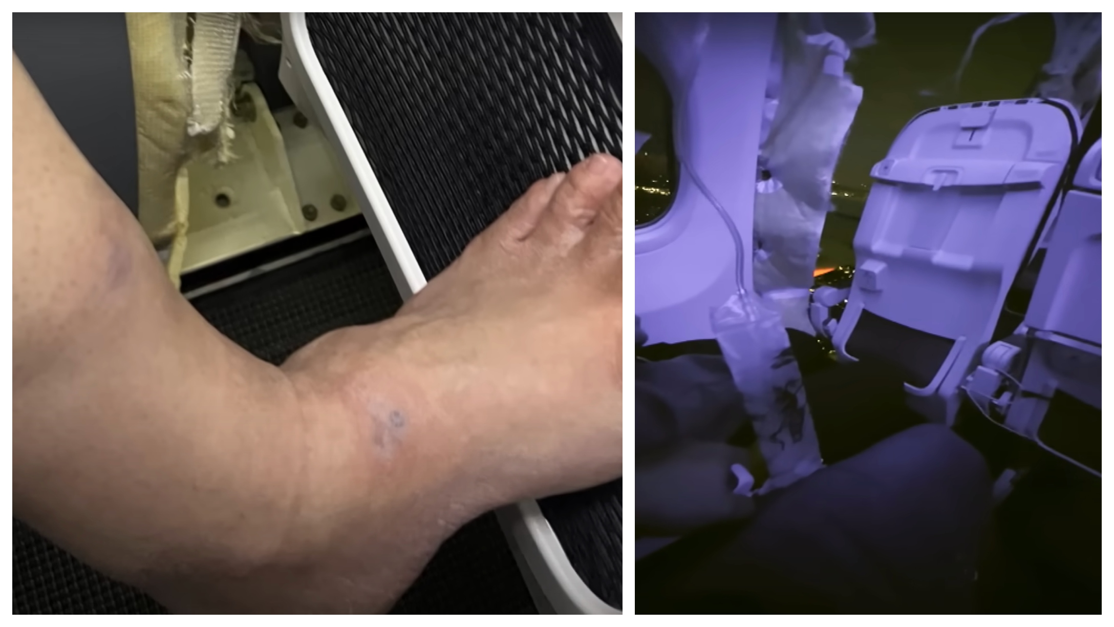 Passenger’s Ordeal Of Having His Shoes Ripped Off Midair After Plane ...