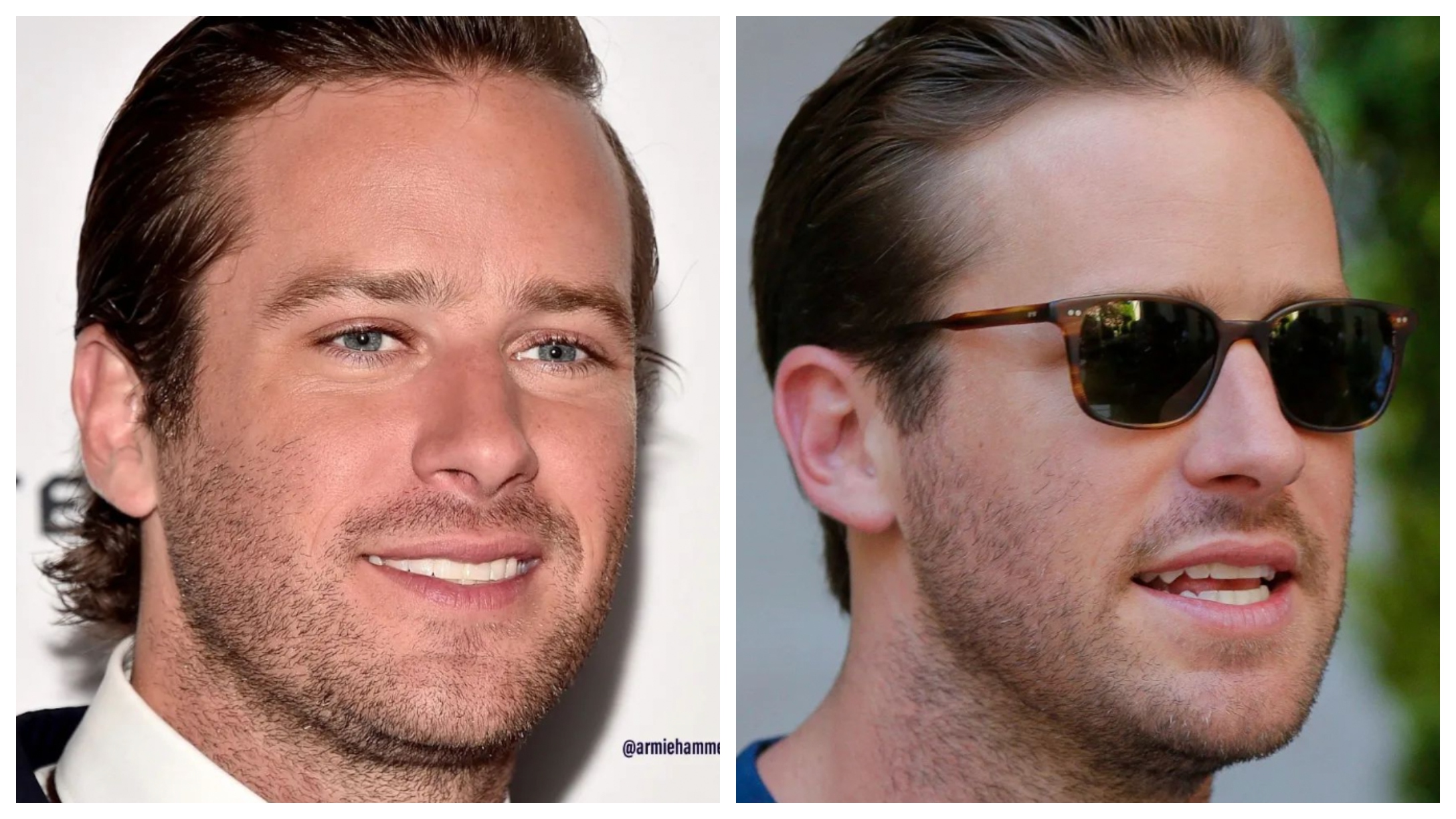 Armie Hammer Breaks Silence Over His Fall From Grace