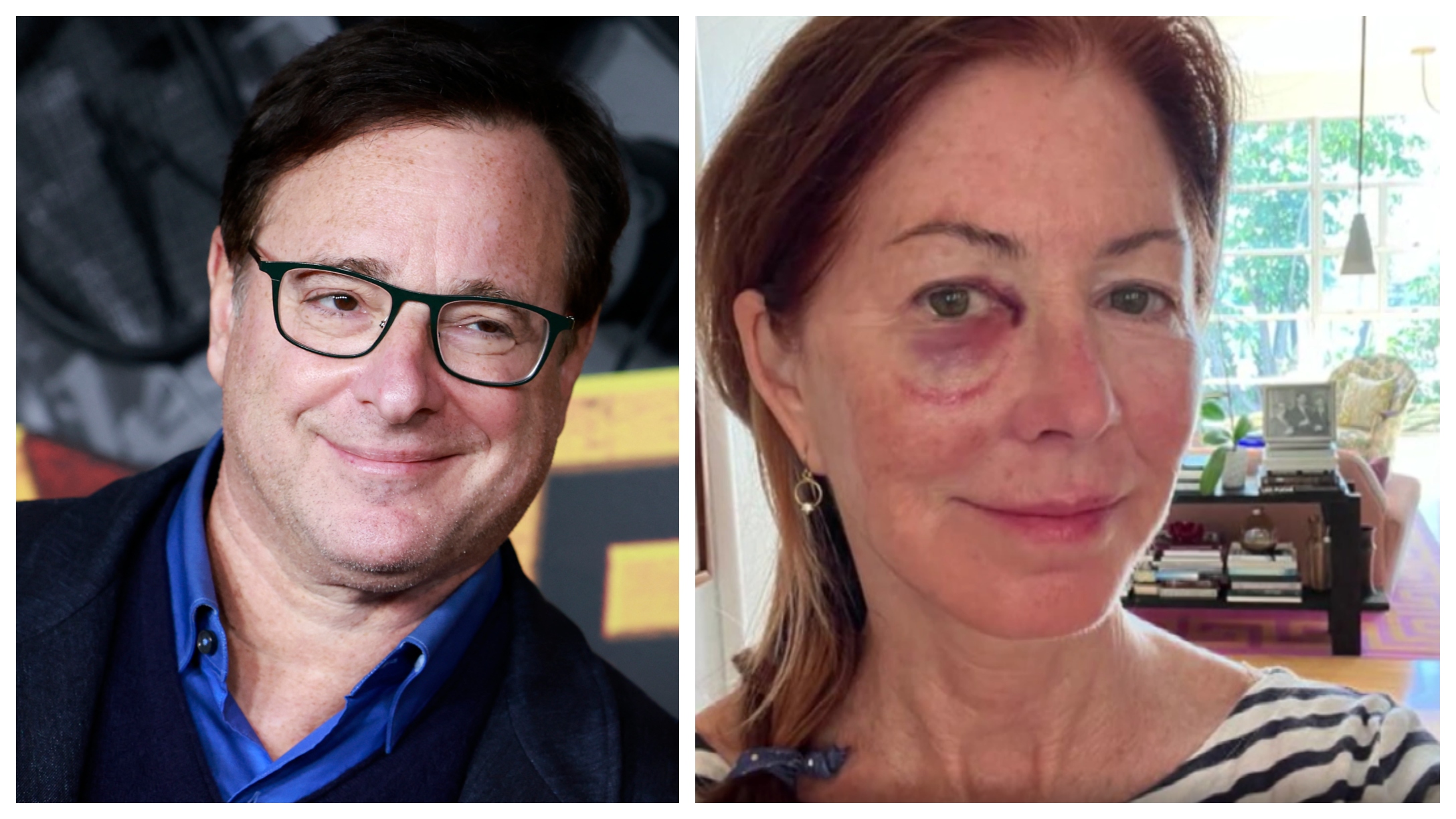 Dana Delany Went To The Hospital After Hitting Head Because Of Bob Saget |  LittleThings.com