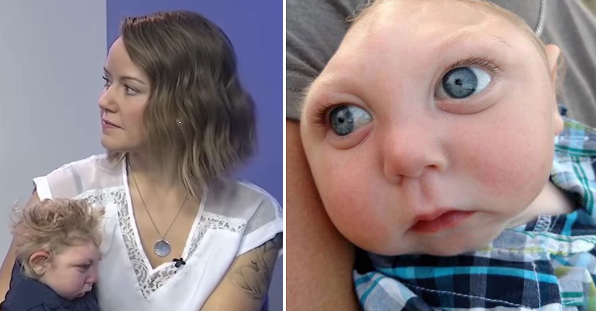 Jaxon Buell, The Boy Born Without Parts Of His Skull, Passes Away