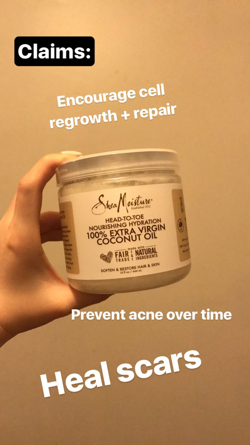 I Tried Coconut Oil For Acne Scars And It Kind Of Worked Littlethings Com