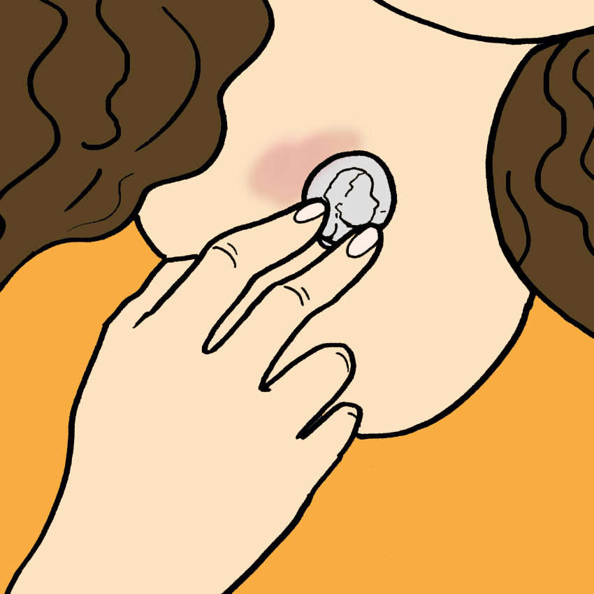 How To Get Rid Of A Hickey The Fast And Easy Way LittleThings