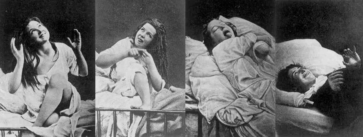 flailing patient being treated for female hysteria