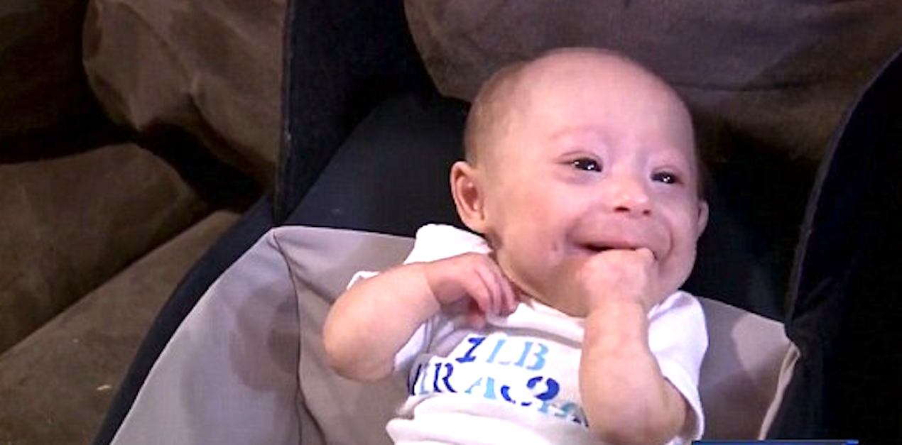 3Pound Baby With Rare Growth Disorder Looks Like A Newborn, But He’s 7