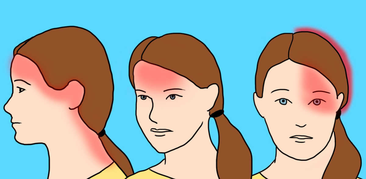10 Common Headache Types And What They Really Mean Littlethings Com