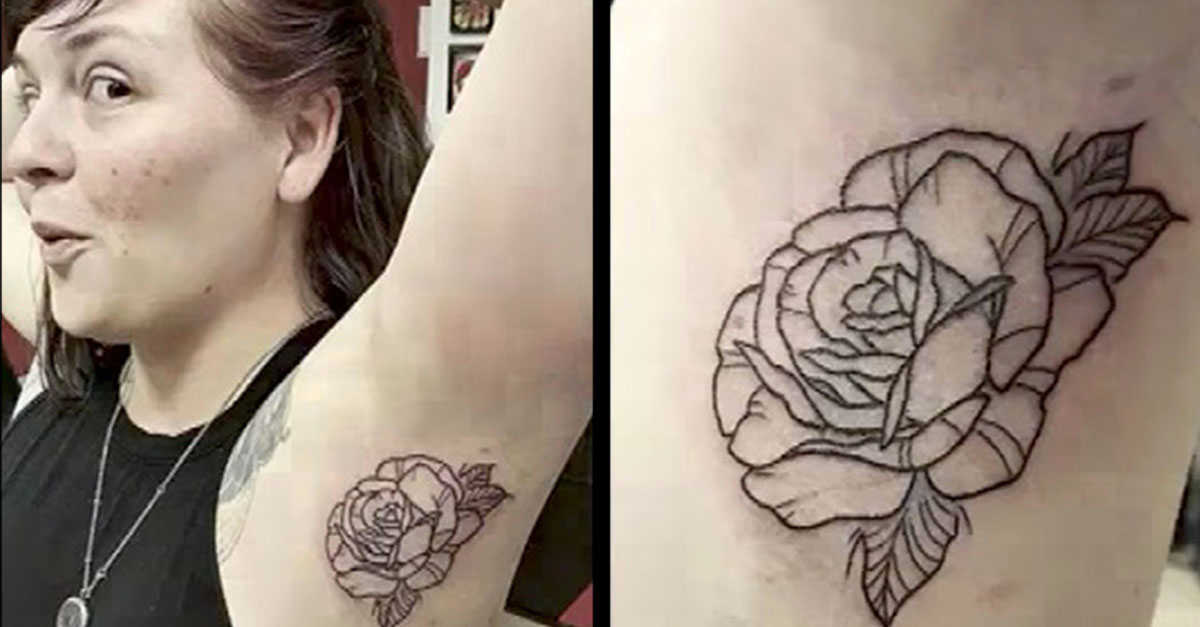 Doctors Mistake Ink Stained Lymph Node For Cancer Littlethings Com