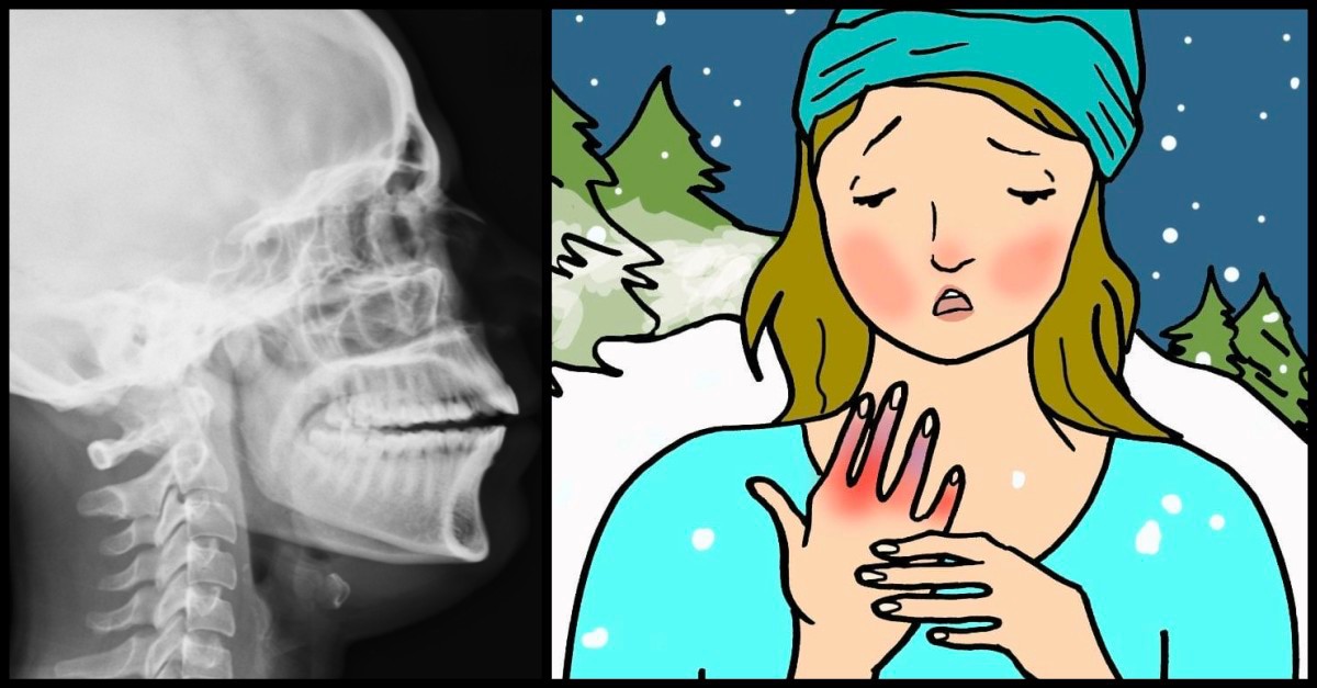 THREE INTERESTING FACTS ABOUT TETANUS visual data 6