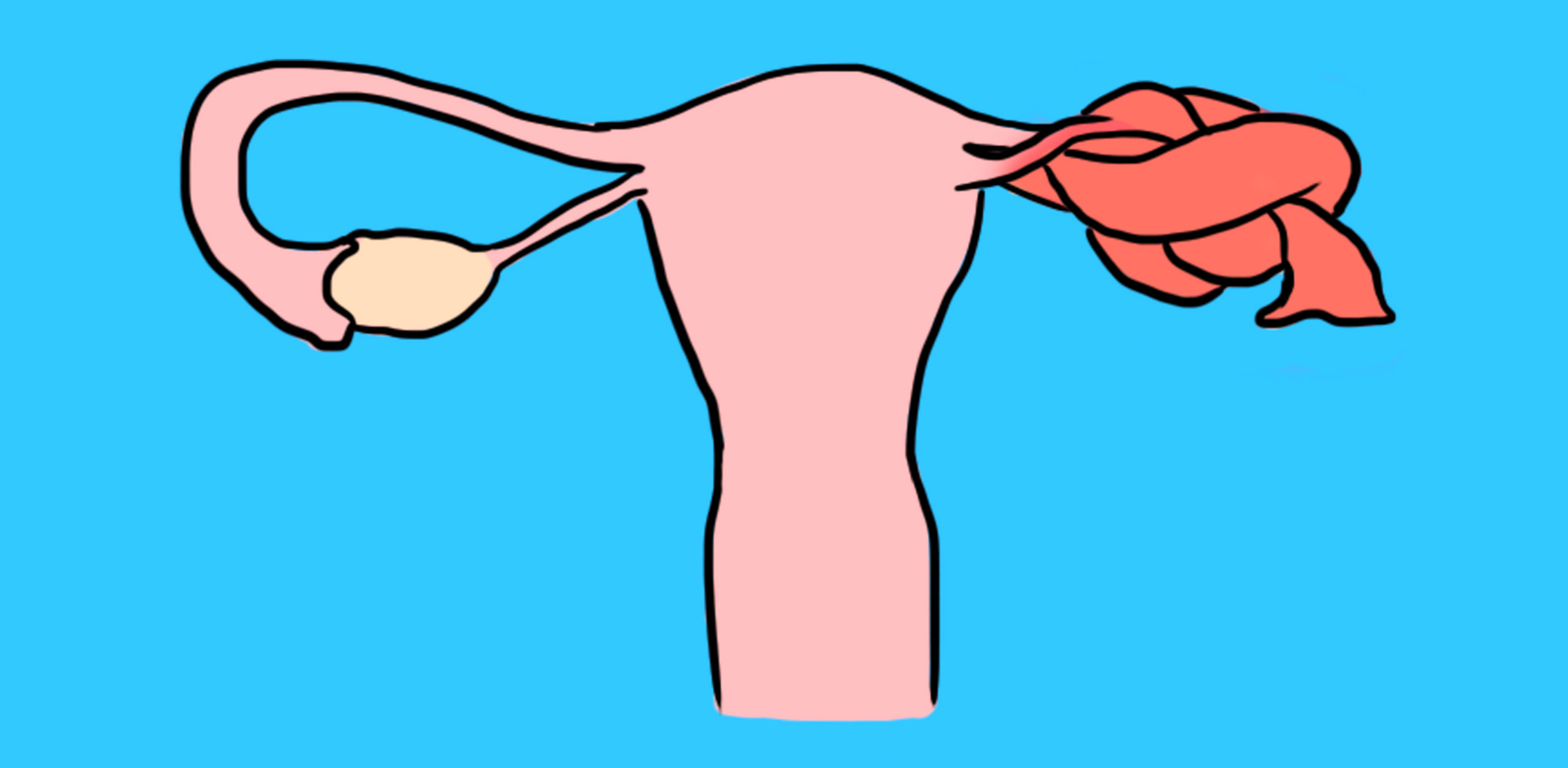 Twisted Ovaries 8 Red Flag Symptoms Women Should Never, Ever Ignore