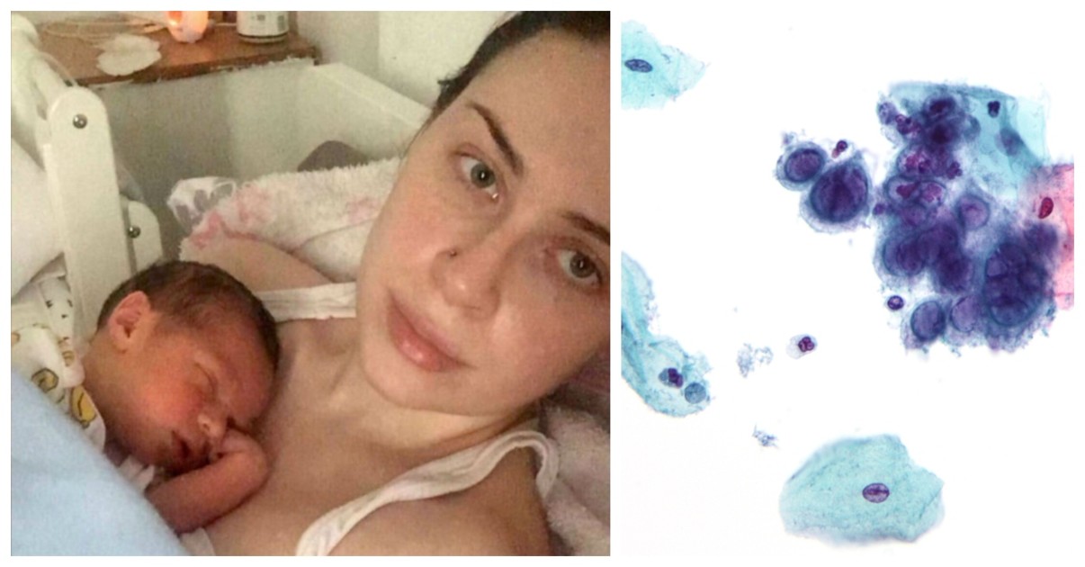 Mom Shares Warning After Losing Her Newborn To Herpes Virus