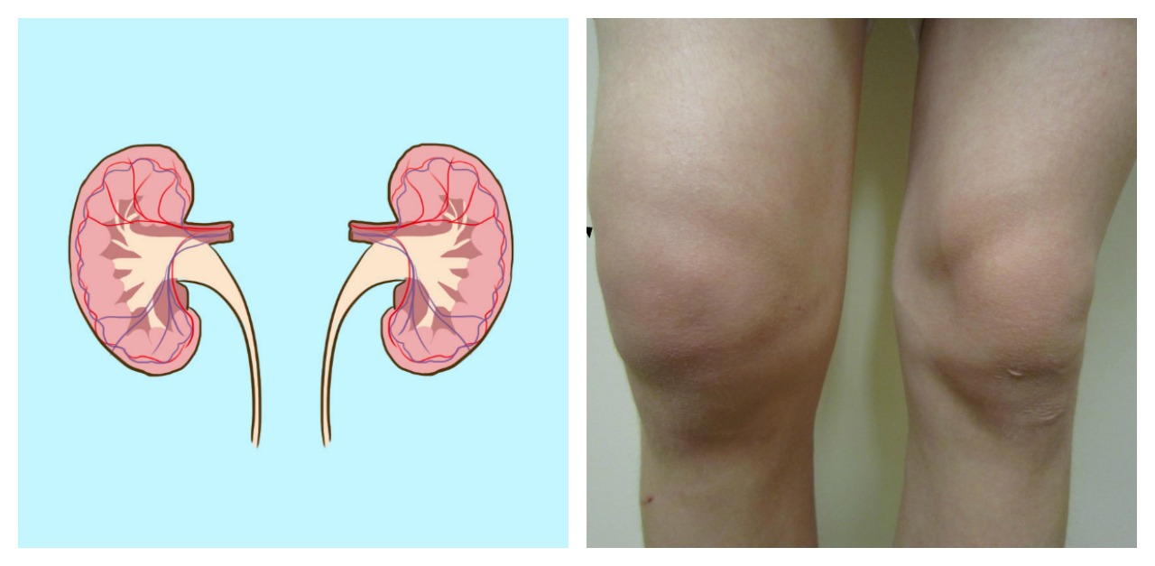 Pressing Your Skin To Test Your Water Retention Littlethings Com