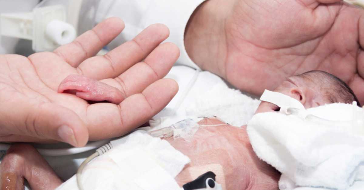 Baby Born Dead Is Deemed A Thanksgiving Miracle Littlethings Com Baby Born Dead Is Deemed A Thanksgiving Miracle Littlethings Com