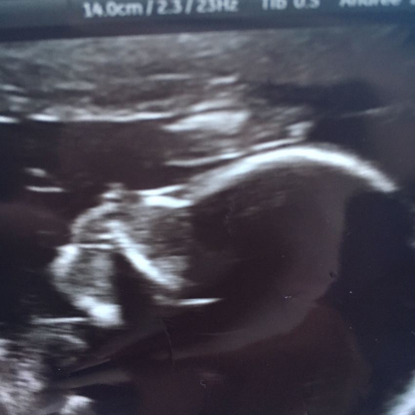 baby-gave-me-ca-139120