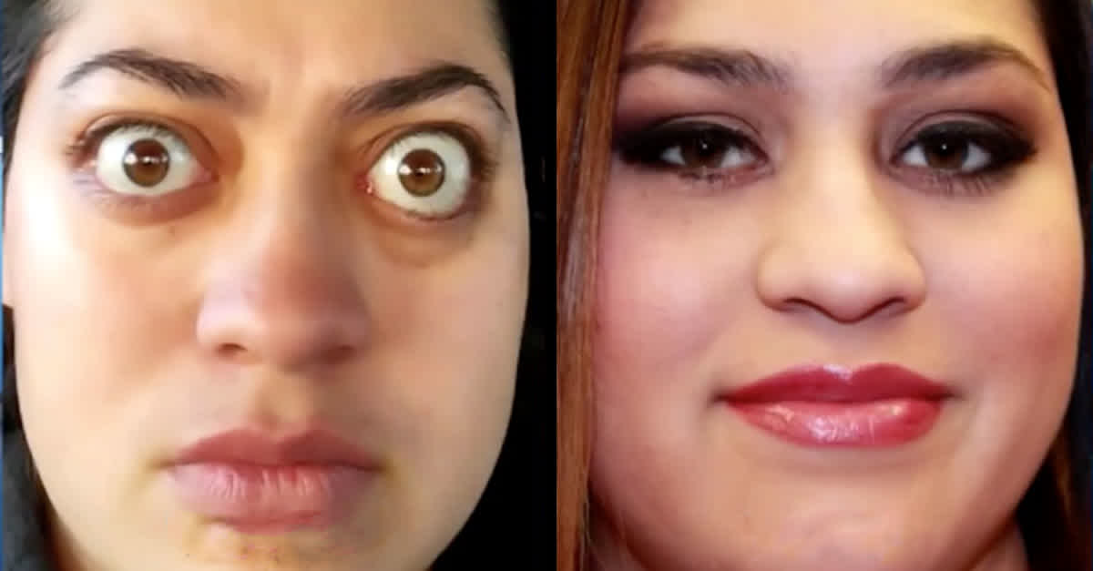 Moms Bulging Eye Transformation Leaves Audience Stunned
