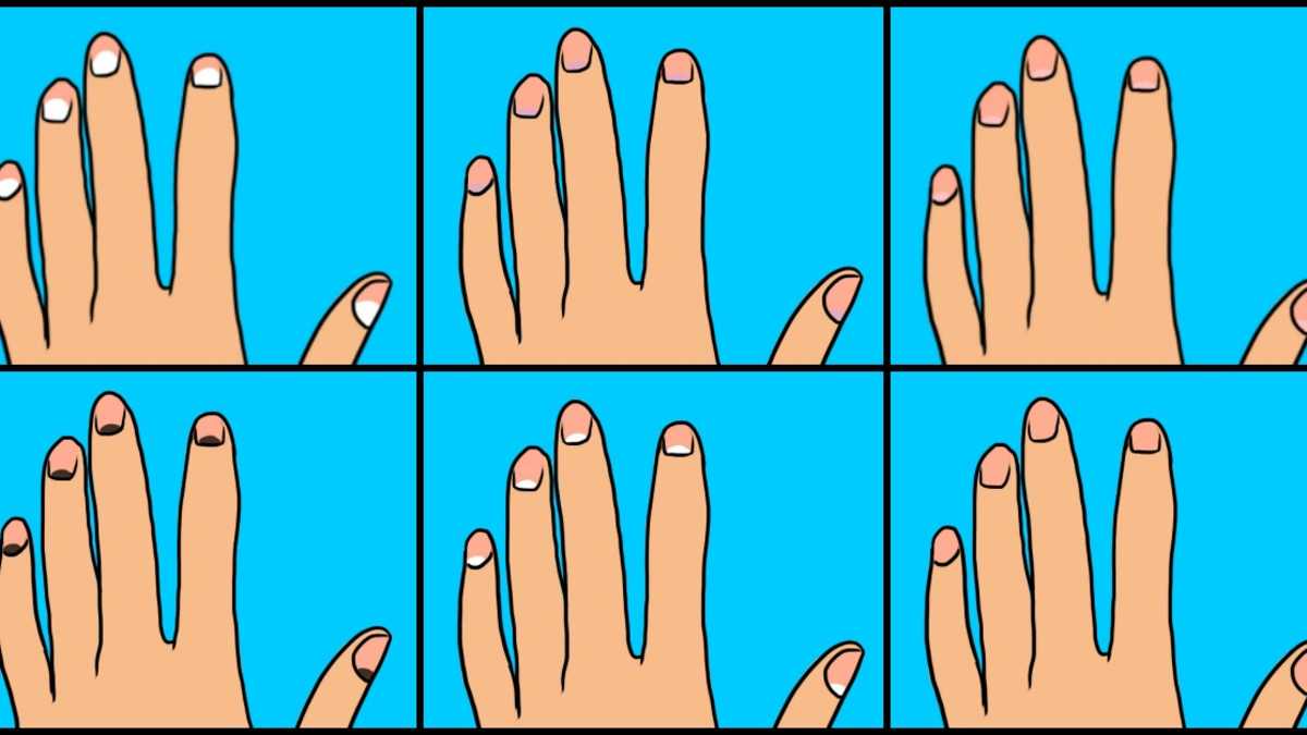 Fingernail Moons Reveal Secrets About Your Health 