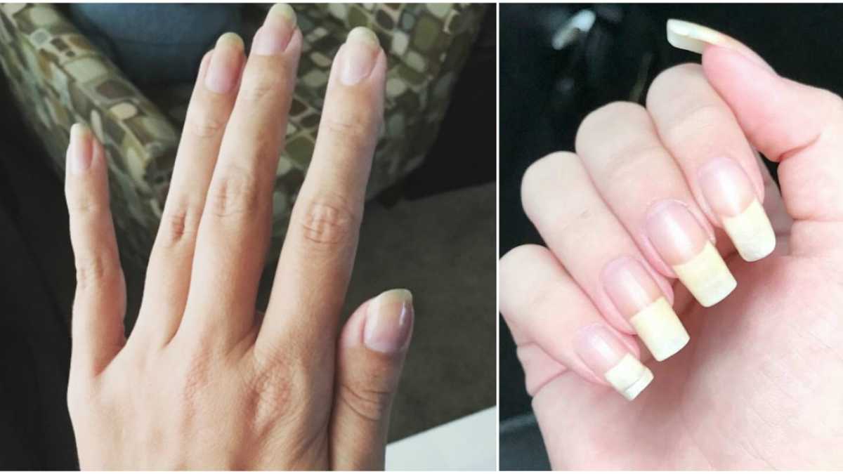 The Shape Of Your Fingernails Says Everything About You 