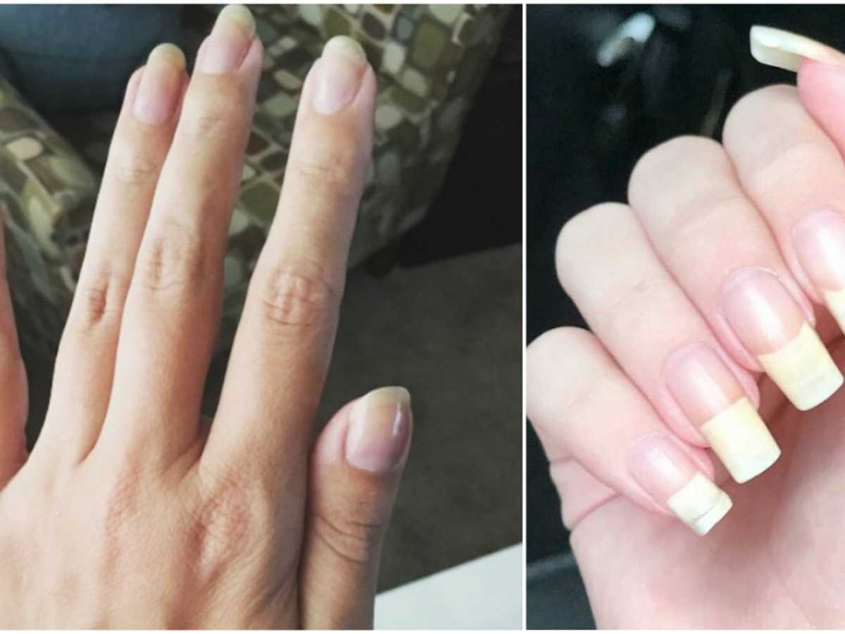 The Shape Of Your Fingernails Says Everything About You 