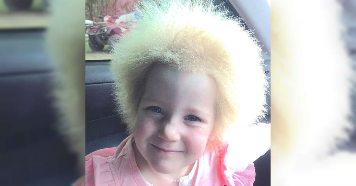 Uncombable Hair Syndrome Is A Real SuperRare Genetic Condition And This  Baby Has It