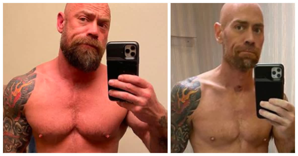 Side By Side Pictures Show How Covid 19 Ravaged Man S Healthy Body Littlethings Com Side By Side Pictures Show How Covid 19 Ravaged Man S Healthy Body Littlethings Com