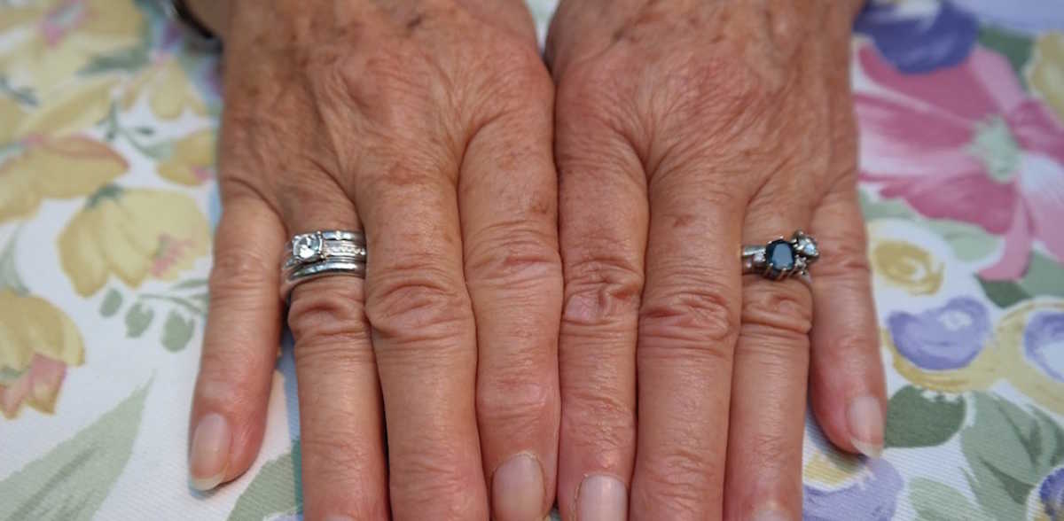 Elderly Lady Is Ashamed Of Her Ugly Hands Until A Nurse Explains Their Beauty