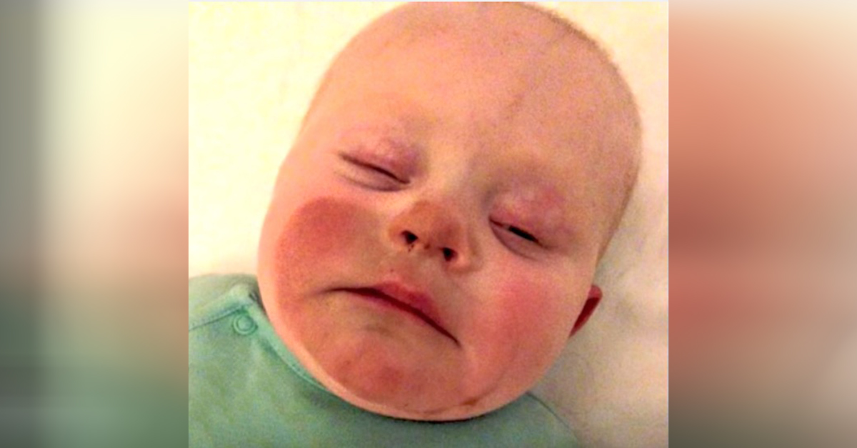 Breastfeeding Newborn May Have Ingested SelfTanner