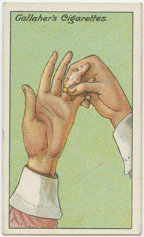 How-To-Remove-a-Tight-Ring-from-the-Finger1 How-To-Remove-a-Tight-Ring-from-the-Finger1