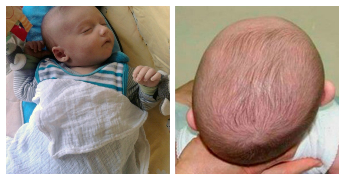 Baby has flat head on store one side