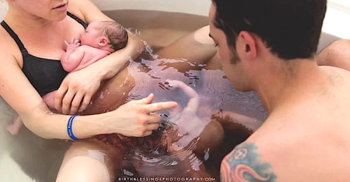 Mom And Dad Expect Normal Twins, But When They See The Second Baby Like THIS? Unbelievable | LittleThings.com