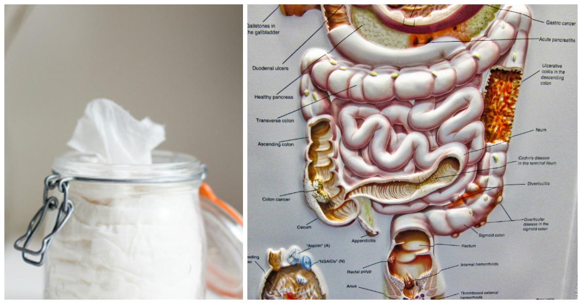 Colonoscopy Prep Tips You Need To Know Before Procedure