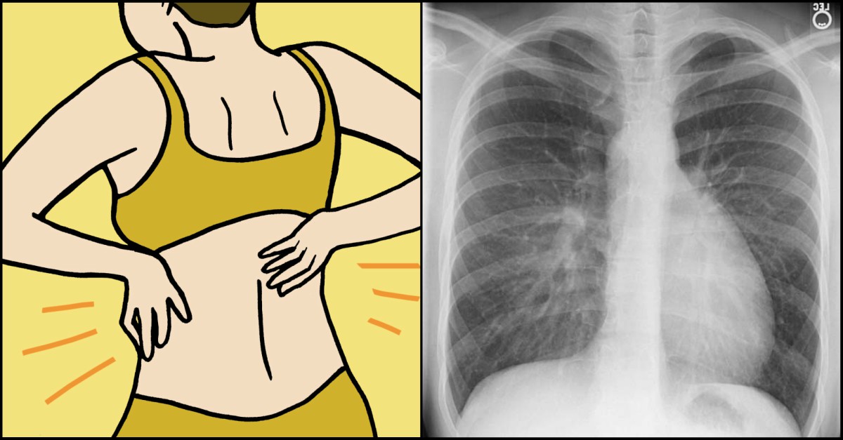 8 Symptoms Of Lung Cancer In Women You Need To Know Littlethings Com