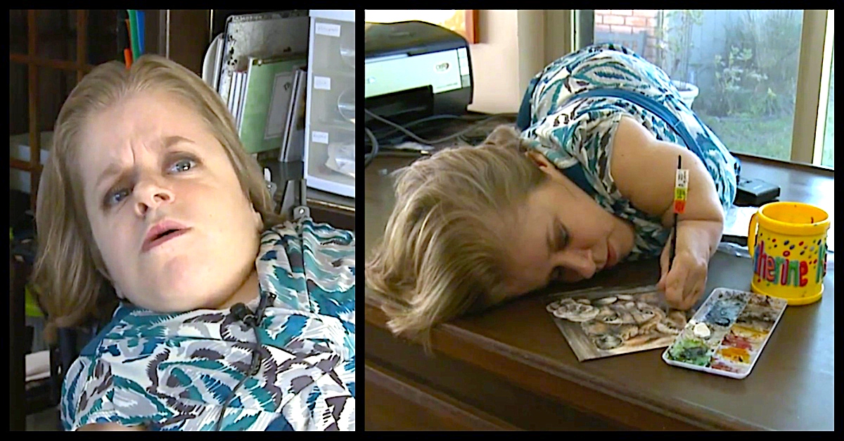 Woman With Brittle Bone Disease An Artist