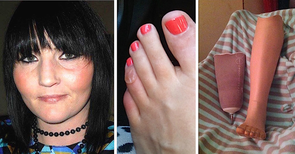 Mom Dances In Stilettos And Wakes Up With Foot Blister, Then Is Shocked