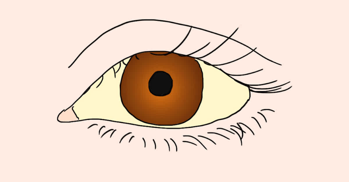6 Causes of Yellow Eyes & When to See a Doctor