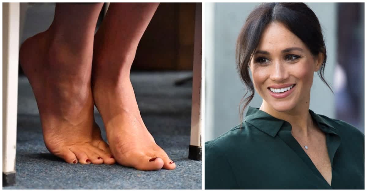 Meghan Markle Has A Foot Condition Called 'Morton's Toe